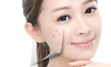 怎样去雀斑有效,美莱去雀斑优势!
