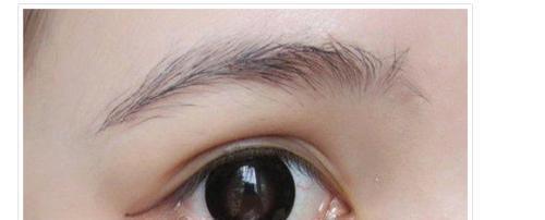 美莱激光脱毛效果怎么样:优点都有哪些