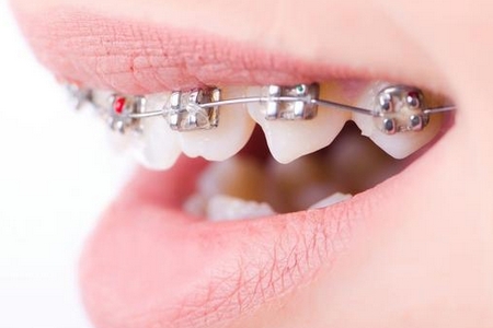 美莱假体隆鼻适合人群都有哪些