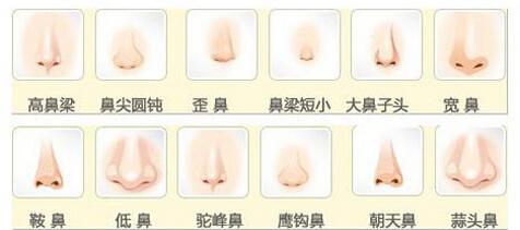 上海注射隆鼻能保持多久,能保持一年时间吗?