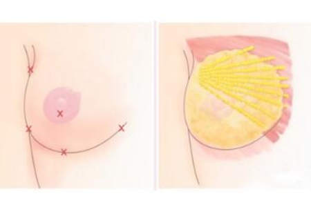 上海瘦脸针打多少量合适、打几次才好