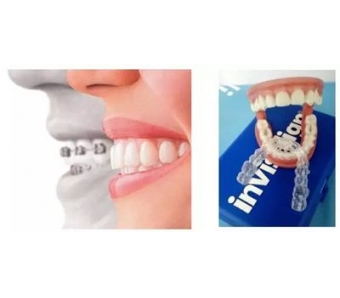 上海下巴整形的后遗症该如何避免