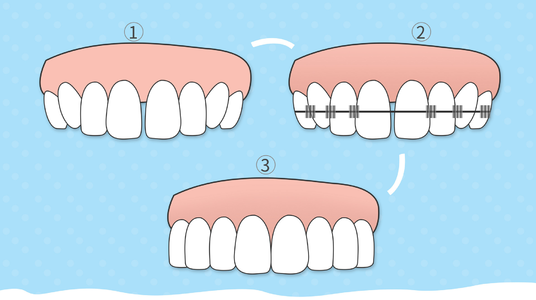 上海下巴整形的后遗症该如何避免