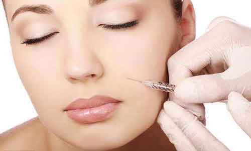 上海美莱注射玻尿酸案例