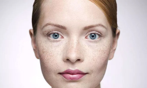 上海美莱鼻综合手术案例