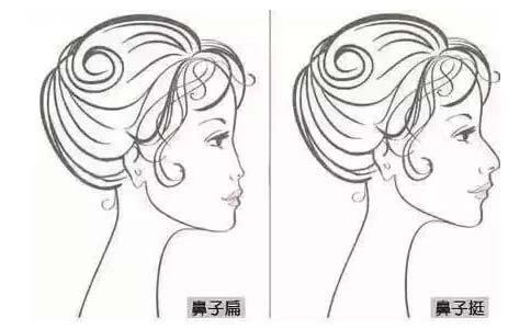 美莱眼部整形双眼皮案例+何祥龙