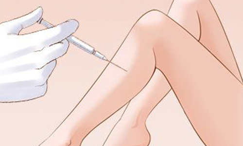 美莱定制双眼皮案例+吴海龙