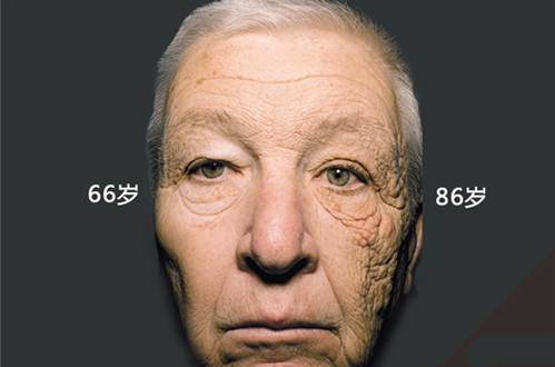 在上海瘦脸针一针要多少钱