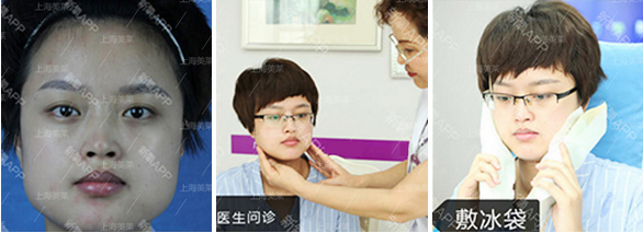 上海光子嫩肤祛斑需要多少钱