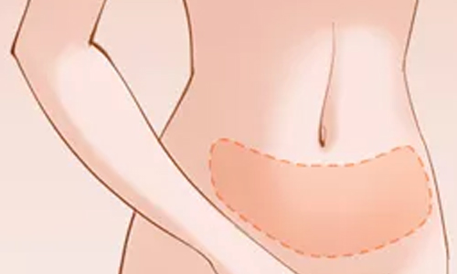 上海冰点脱毛 好不好,会不会有副作用?