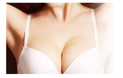 上海整形医院,美莱利用玻尿酸除皱有什么优势吗