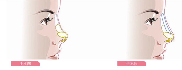 关于年龄偏大能牙齿矫正吗上海