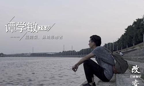 上海假体隆鼻能保持多少年,注意事项有哪些?