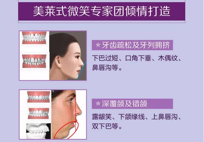 上海自体脂肪丰胸下垂会不会