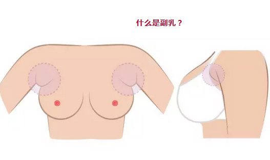 美莱医生科普:乳房下垂怎么办呢?