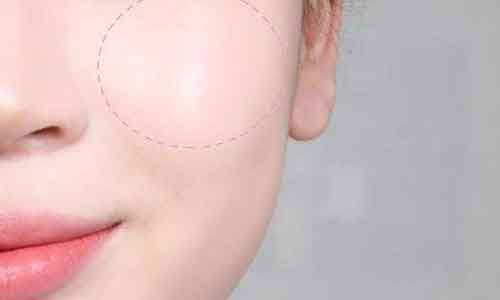 上海打瘦脸针危险么?去哪打没有危险