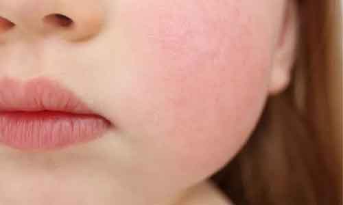 上海医院美莱做自体脂肪丰太阳穴大概多少钱？