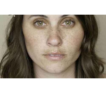 上海吸脂医院,腹部去除赘肉好的方法