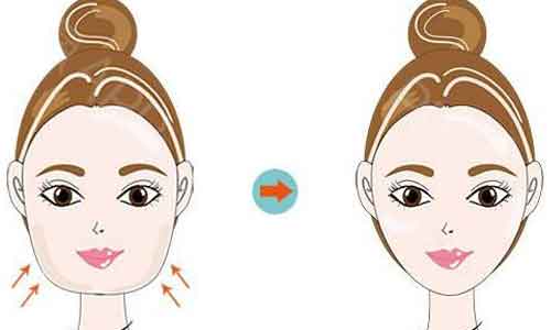 上海哪里做假体隆鼻技术好,专不专业?