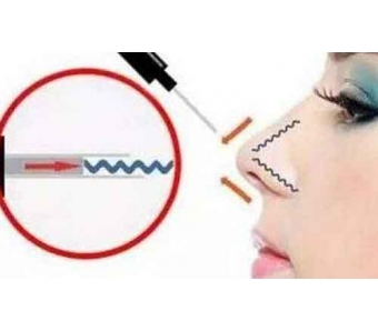 美莱牙齿科普:为什么要矫正牙齿不齐