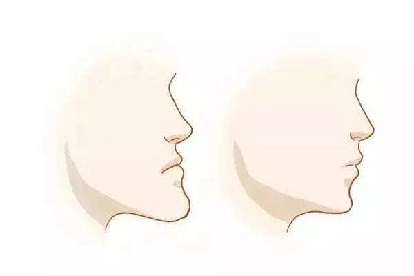 上海美莱整形打了瘦脸针见效快吗