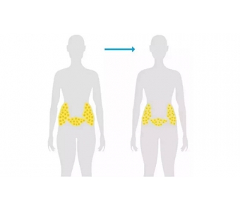 上海美莱整形打了瘦脸针见效快吗