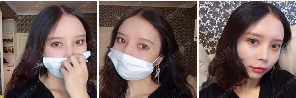 上海瘦脸针打多了好吗,打多了会怎么样?