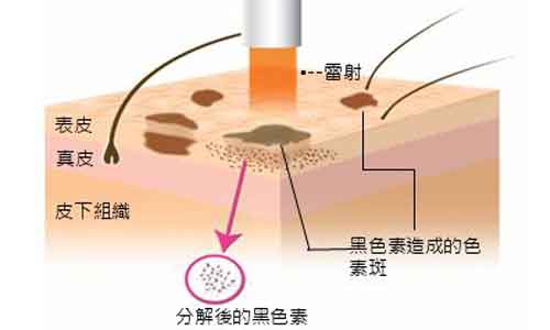 皮肤护理小误区，上海美莱为您揭晓！！！