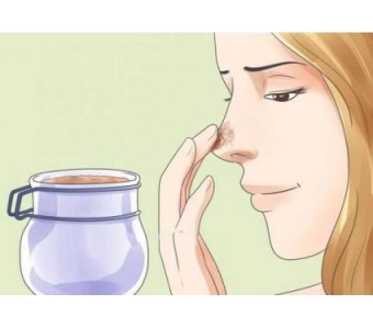 上海做了膨体隆鼻手术效果自然吗?