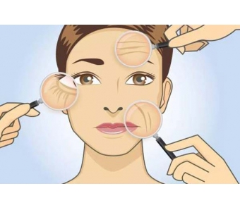 上海埋线双眼皮术前术后的注意事项都有哪些≥来了解一下!