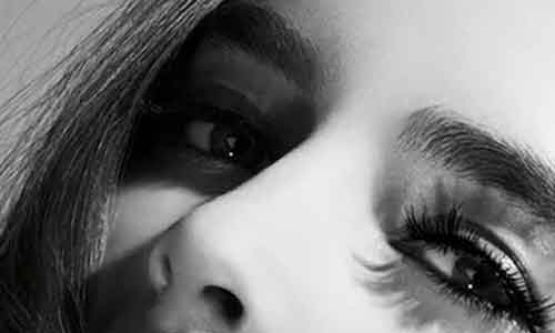 上海割双眼皮到底有多痛∷会打麻醉吗?