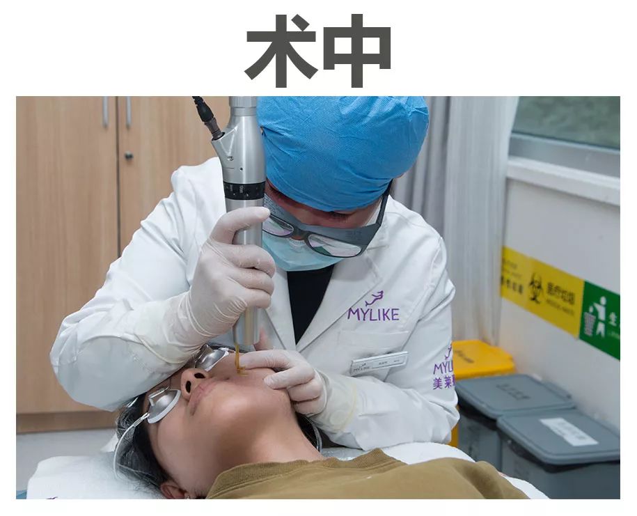 美莱面部吸脂手术后外表会看出明显手术疤痕吗?