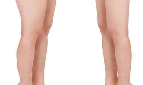 <美莱>打完瘦脸针后的注意事项都有哪些?