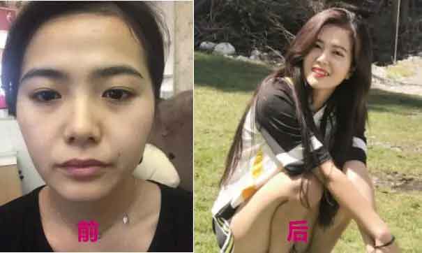 在上海做吸脂手术安全吗?