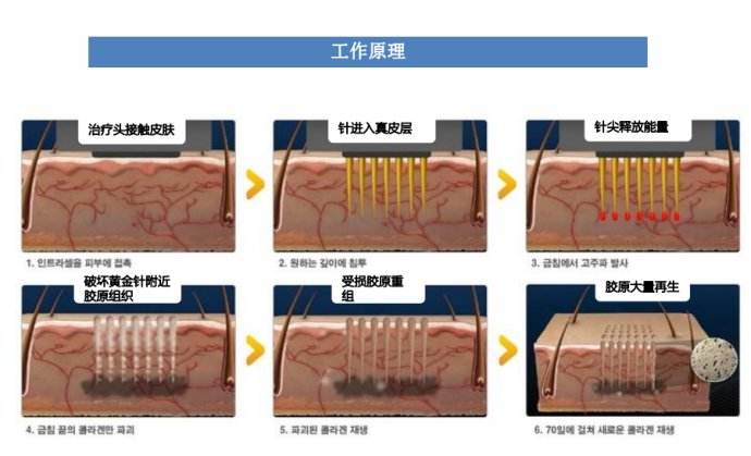 上海正规医院做双眼皮手术的危害大吗