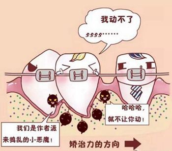 上海长宁区美容医院自体脂肪丰额头多少钱