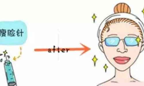 美莱神奇祛眼袋手术,女性们超爱的“减龄"术