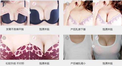 美莱做手臂吸脂手术前需要的注意是哪些