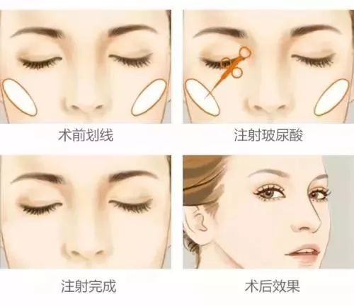 上海皮肤美白医院，激光美白效果好吗