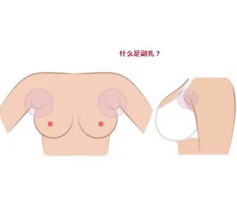 隆胸修复医院，上海一般做隆胸修复要多少钱