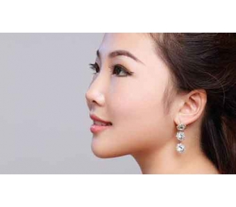 上海医院全切双眼皮可以割两次吗?