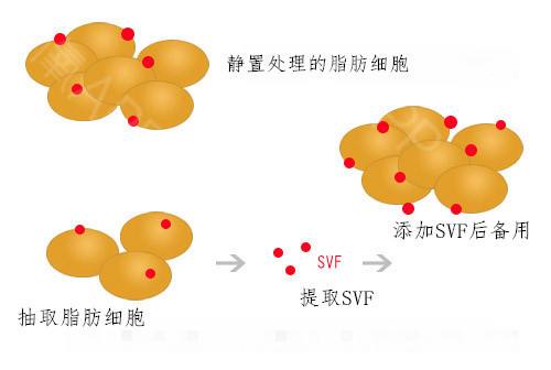 看看上海美莱丰苹果肌之后,整张脸怎样变化?