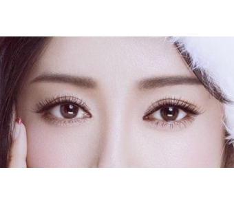 看看上海美莱丰苹果肌之后,整张脸怎样变化?