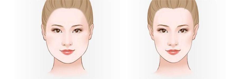 上海美容院做激光祛红血丝一次〢多久见效果?