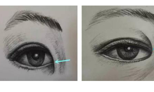 上海美容院做激光祛红血丝一次〢多久见效果?