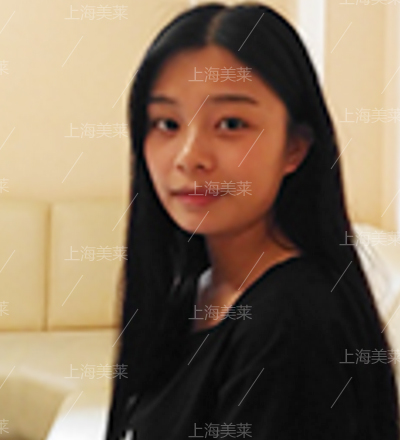 在美莱做完激光点痣后多久能碰水?还要注意哪些?