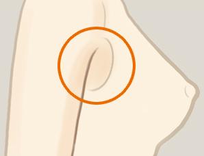 美莱整形美眼术,个性设计不追求大眼!