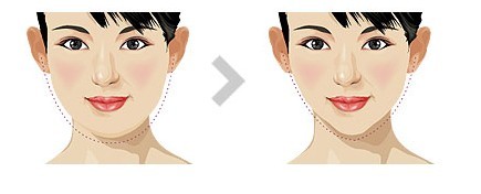 怎样祛斑有效?美莱整形综合祛斑!