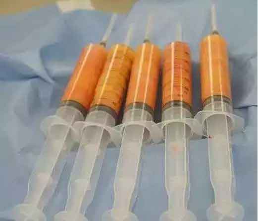 为什么脸上会长斑?美莱祛斑医生来科普!