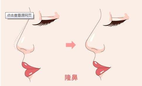 为什么脸上会长斑?美莱祛斑医生来科普!